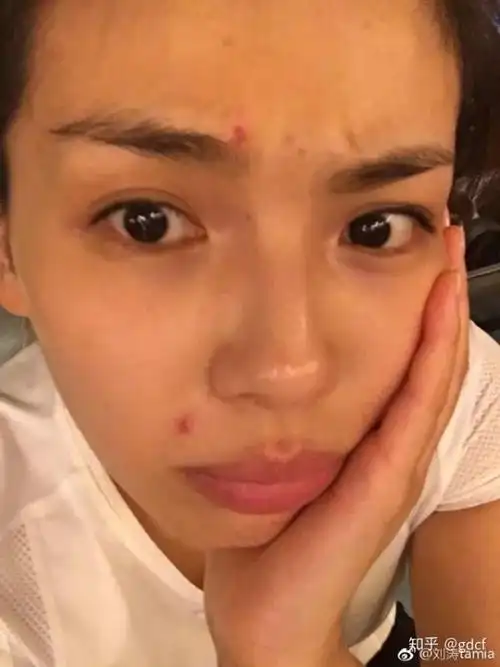 女明星熬夜拍戏照样长痘,她们还不是靠这几招续命!