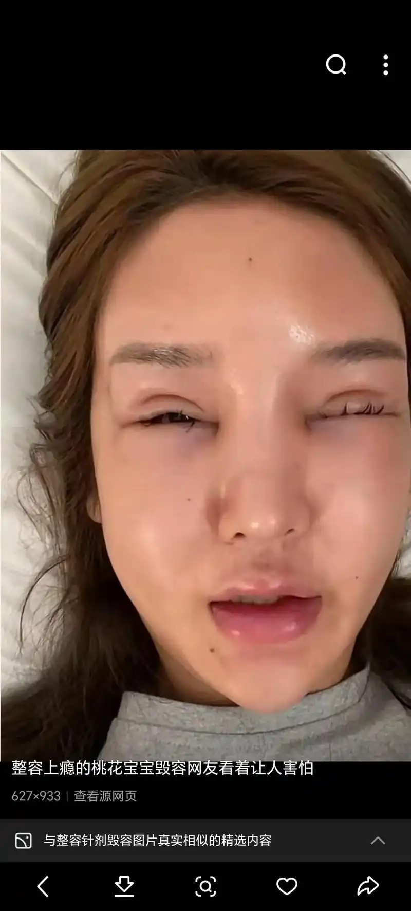 1000查看源网页微整形黑作坊再次曝光针剂假药为何屡禁不止美空郑爽嘴