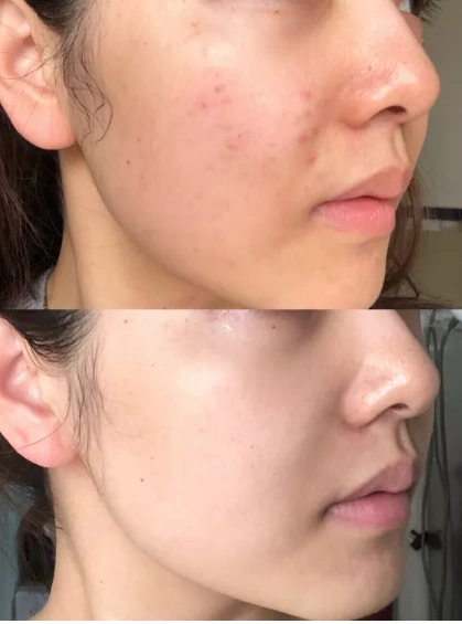 面膜干货 | 皮肤太白是啥体验?让人无限回购的美白面膜.