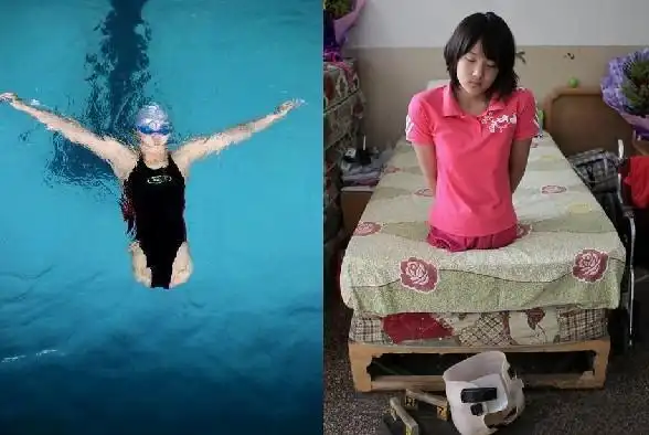 4岁车祸双腿截肢,靠半个篮球获游泳冠军 如今变美女公开找男友