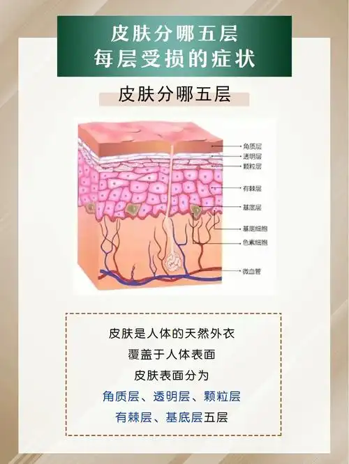 皮肤分哪五层,每层受损有哪些症状?