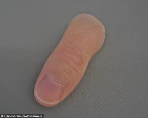 "超仿真"假肢难辨真假 外观好看活动差(图)