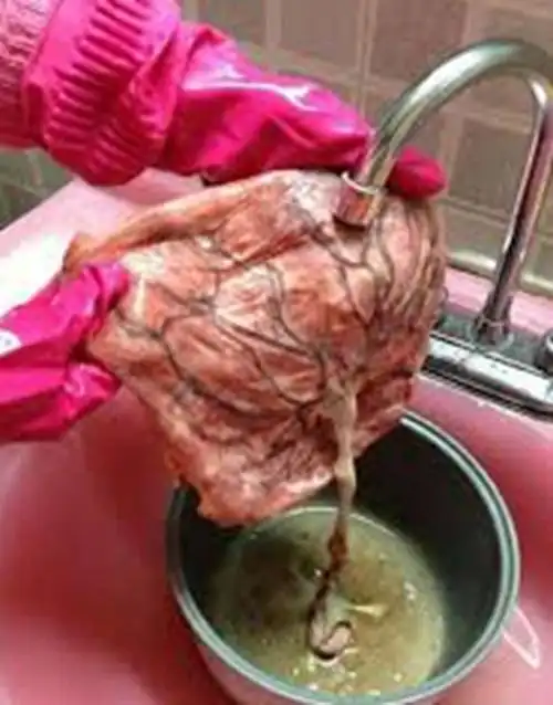 人胎盘详细的特征图片