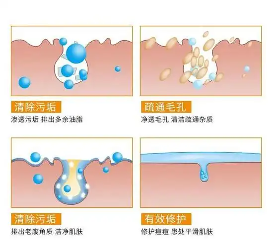 清洁污垢修复皮肤 温和清除肌肤残留多余的油脂和老旧角质 减少毛