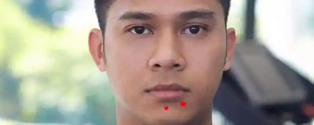 1,左下巴主财富,左下巴有痣的男人代表一生福禄双全,享尽富贵荣华.