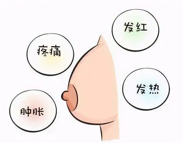 哺乳期乳头疼痛是怎么回事该怎么办