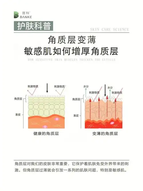 角质层变薄敏感肌如何增厚角质层