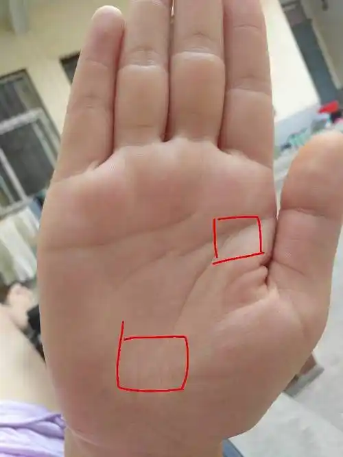 生命线末端有三角纹和生命线起端有岛纹,是不是代表身体会出病啊