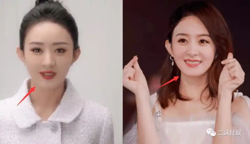 赵丽颖变化巨大,像个假人,疑似整容失败_视频_减肥_口红