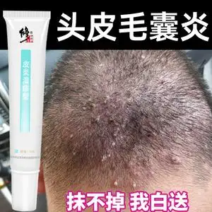 屑癣头上长痘痘结痂可搭毛囊炎洗发水专用非药膏中药克星0人付款58