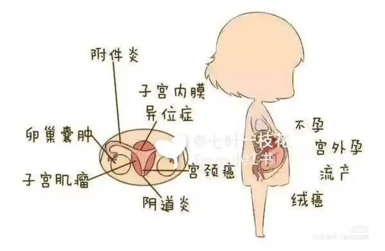 感染了hpv有什么症状如何防治