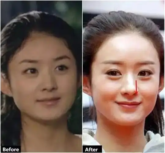 赵丽颖整容史今天带你扒一扒