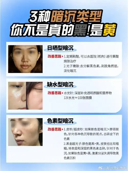 日晒型暗沉:肤色比手臂,小腿的肤色还要深,皮肤摸起来比较粗糙,有