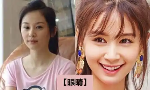 王子文深陷整容风波,前后判若两人