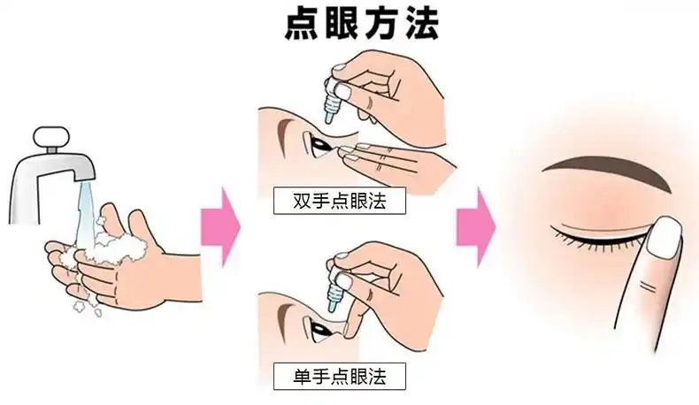 4,将眼药水滴于下方结膜囊内,不要点在黑眼珠上,闭眼休息 .