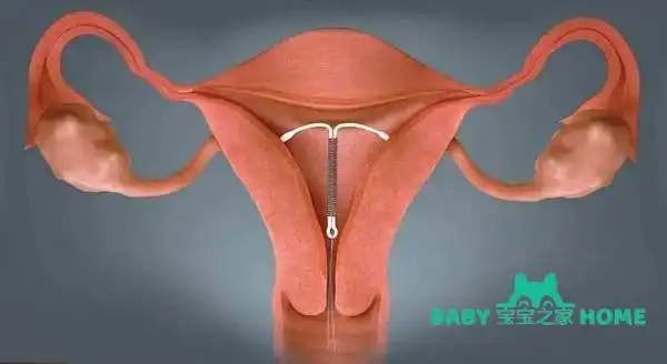 2022最新避孕环哪种最好附2022最新款避孕环推荐费用一览