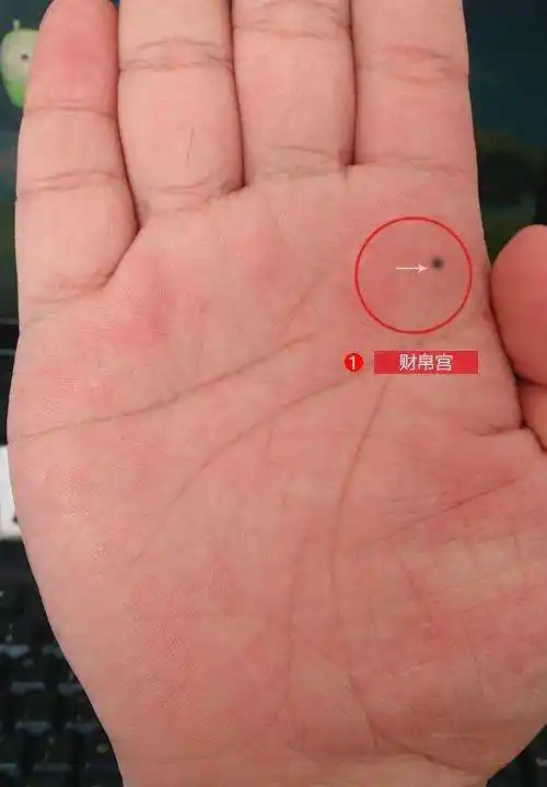 如果手相上有这颗痣,注定穷一生,十分不好!
