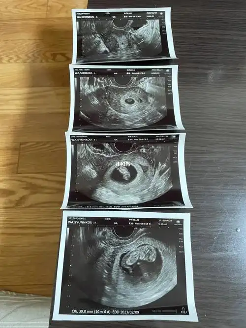 日本怀孕#日本孕期#日本生活#孕期日记