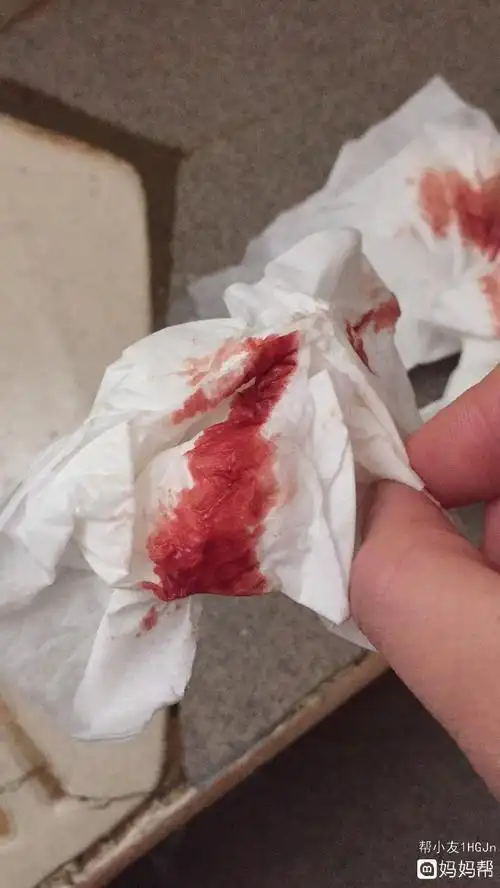 为什么怀孕梦到流血了呢(为什么怀孕梦到流血了呢怎么回事)