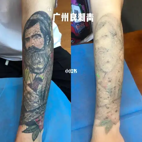 洗纹身对比效果