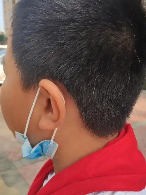 孩子有这么多的白头发怎么回事