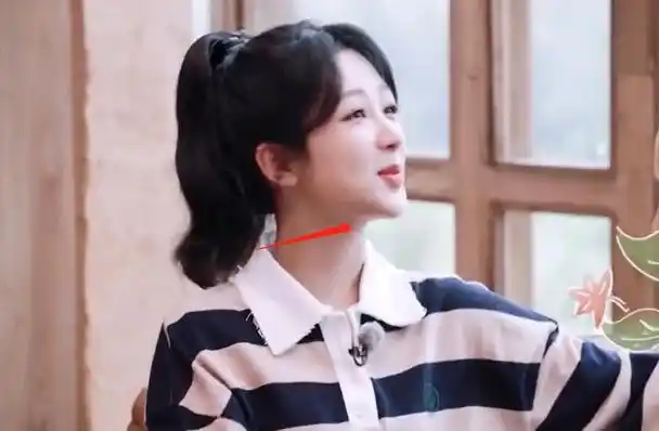 杨紫综艺上线暴露状态法令纹夸张下巴变尖网友吐槽医美后遗症