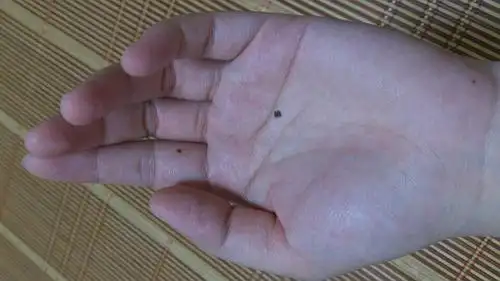 有没看到过右手掌心有痣的男生