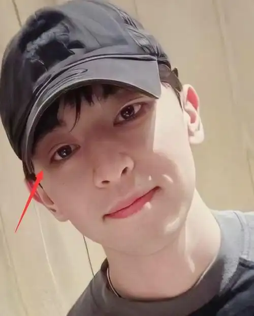 邓伦近照大变样疑整容变双眼皮与圈内明星一起参加婚礼成焦点