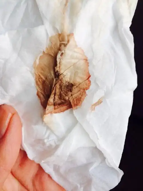 怀孕两个多月分泌物白带褐色_有来医生