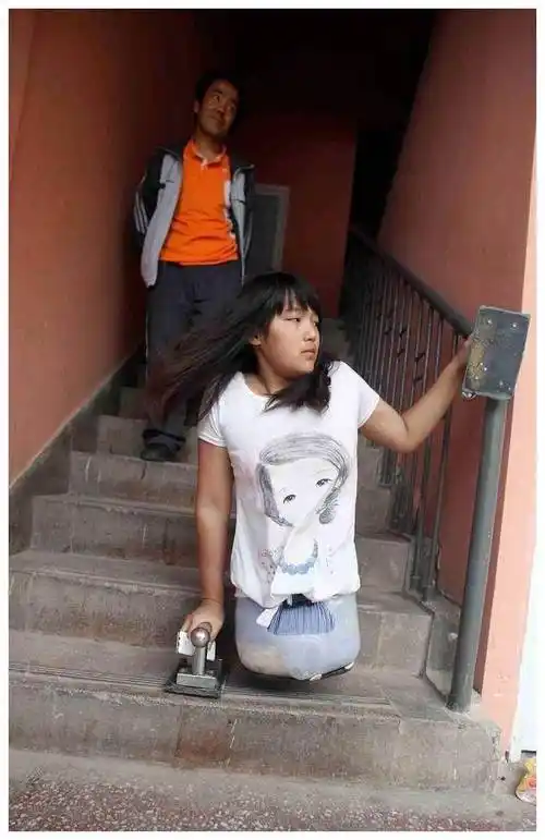 4岁车祸截肢女孩,绽放成亭亭玉立的28岁少女._钟红艳_生活_残疾人