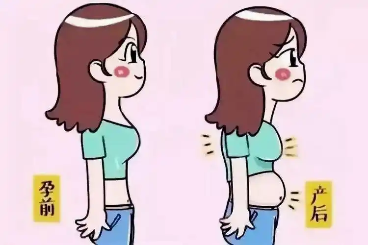 生完孩子后"肚子怎么做都收不回去"!元凶就是这块"腹直肌".