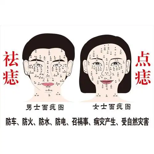 去痣挂什么科 什么样的痣需要去除