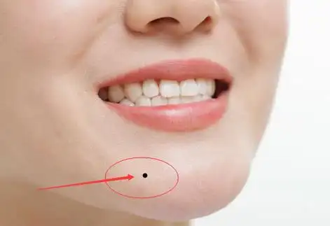 下巴有痣代表什么意思,下巴有痣好不好