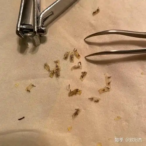 28岁割包皮亲身经历实时更新