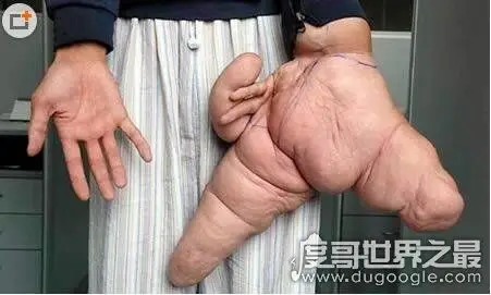 世界上最铁的手印度猛男徒手1分钟劈开124个椰子创世界纪录