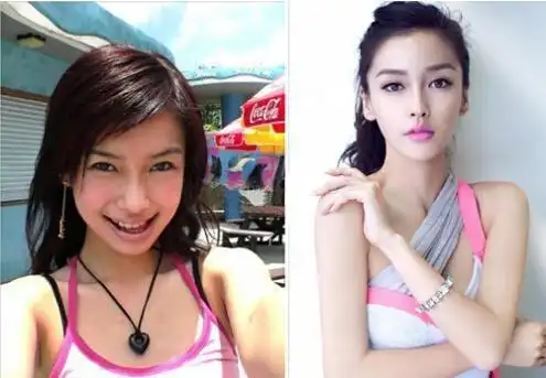 娱乐圈整容最成功的10位女明星