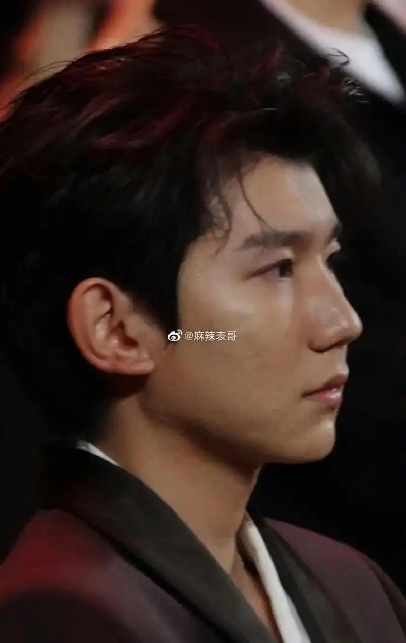 王源这皮肤状态真的不太好