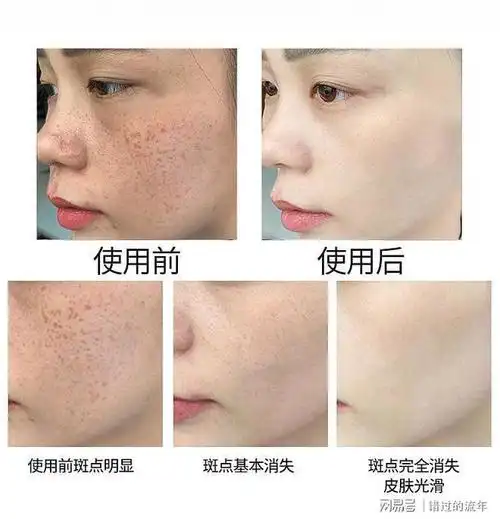 美白淡斑哪个品牌好?选择这几款,助你拥有无暇美肌