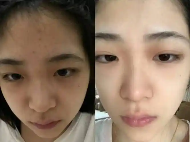 补水面膜哪个牌子效果好?最新面膜排名,认准这几款