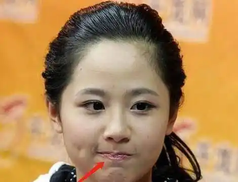 看了杨紫的近照,真是让人心疼,唇纹深还起皮,网友:别嘟嘴了!_嘴唇_时