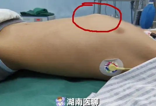 鸡胸是什么(鸡胸是什么样子的)