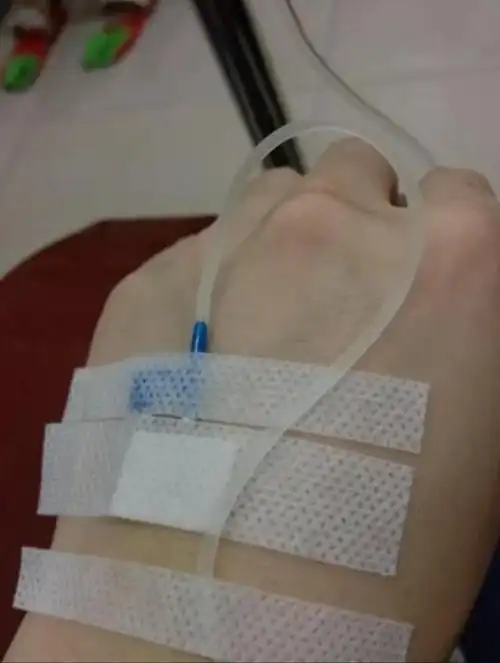 每个人都经历过生病到医院打针输液,照理说在输液时