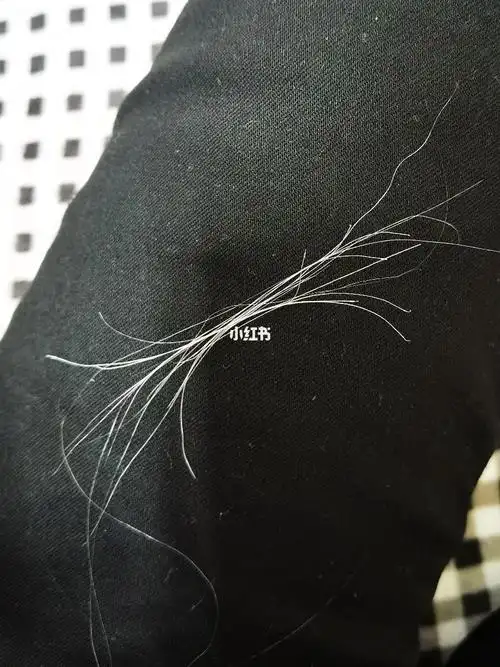 数一数有多少根白头发