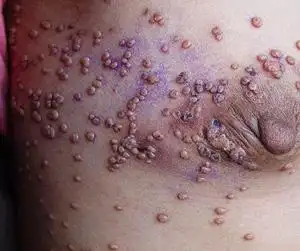 艾滋病试纸_艾滋病检测试纸哪里有卖-艾滋病检测网