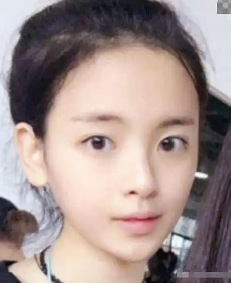 网上有一位整容医生说杨超越以前组合出道前去过他那整容.