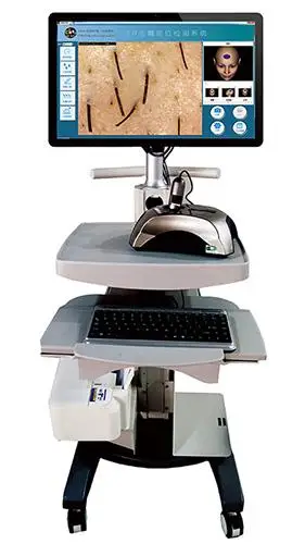 台湾cbs皮肤镜影像检测系统-技术设备-保定华仁皮肤病医院