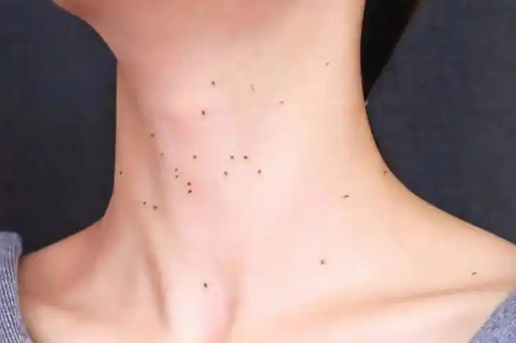 hpv感染症状有什么具体表现_生殖器_宫颈_检查