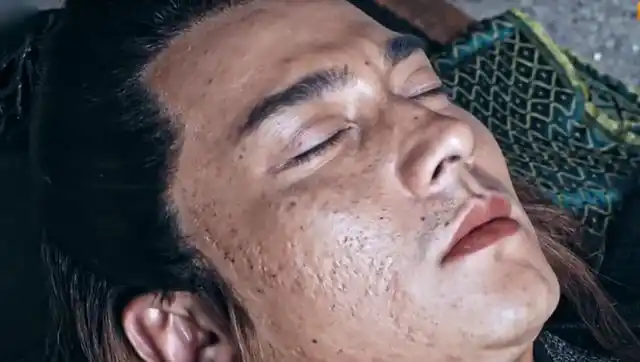 脸上坑坑洼洼的,简直不像是一个明星的脸,因为在大家印象当中明星都是