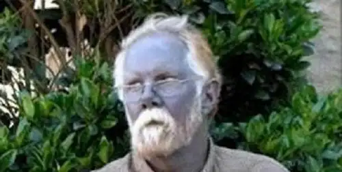 世界上绿种人不足3000,血是绿色,他们靠光合作用能活下去?