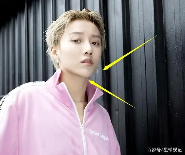 刘雨昕的脸怎么了?下巴意外"凸出"一块,后期都没办法帮她修图